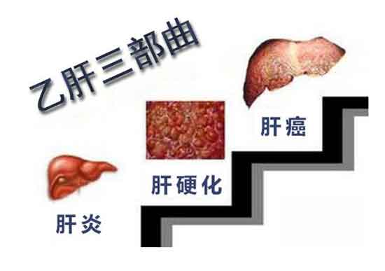 郑州有哪些肝病专业医院