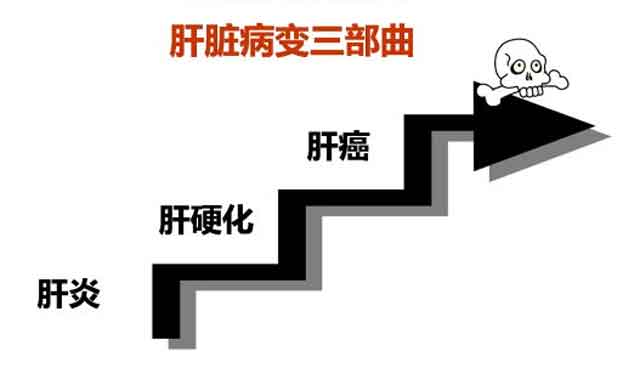 郑州看肝硬化哪个医院好?郑州哪个医生看肝硬化