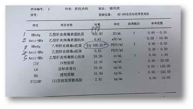 郑州肝病专业医院哪个看肝病比较好