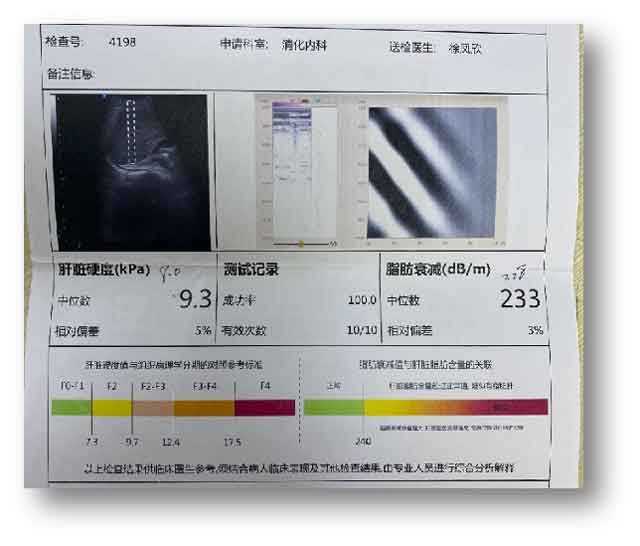 郑州肝病专业医院哪个看肝病比较好