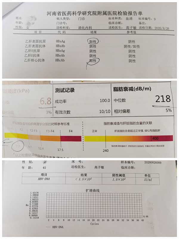 郑州看乙肝比较好的医院是哪家